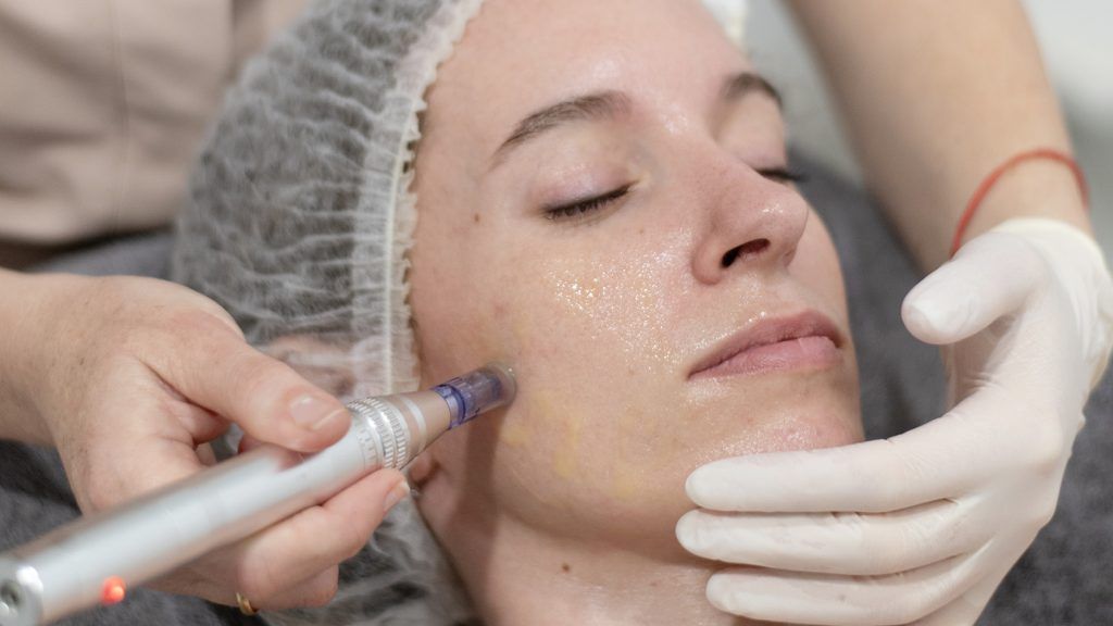 tratamiento retinol