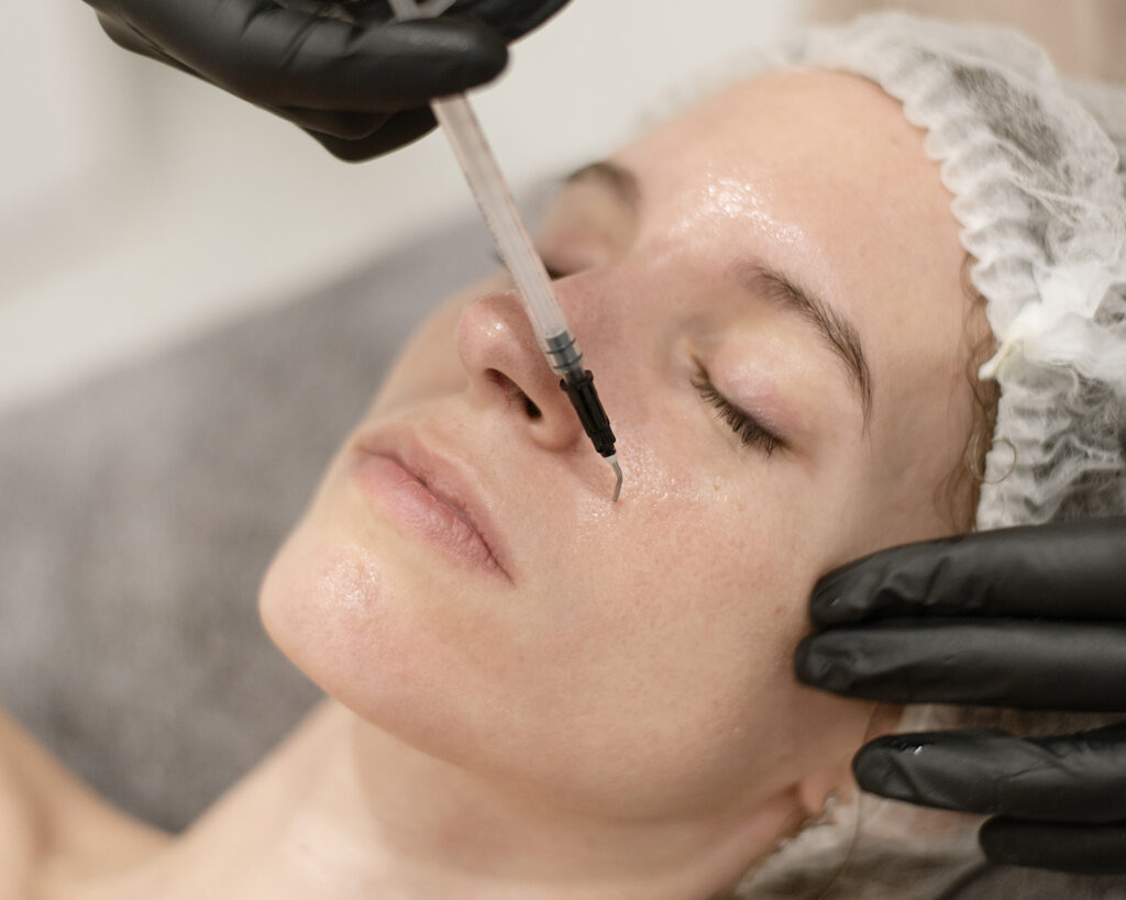 Los beneficios del peeling